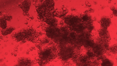 Red:1rjoyd32uuy= Blood